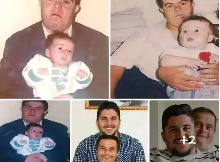 Poder y Superación: La Emocionante Historia de un Padre con Síndrome de Down y su Hijo Médico