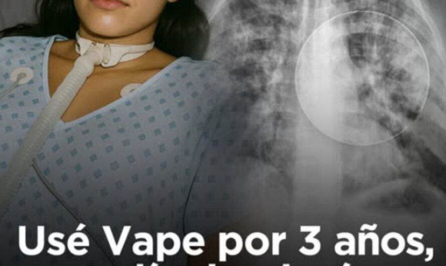 El estremecedor testimonio de una joven que perdió un pulmón por vapear