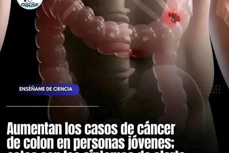 Conoce los Síntomas del Cáncer de Colon: Prevención y Concientización