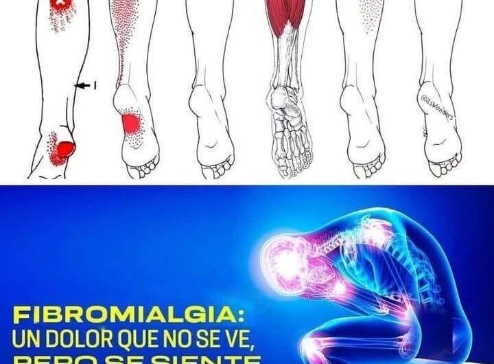Fibromialgia: La Enfermedad de las Emociones No Expresadas y Remedios Naturales