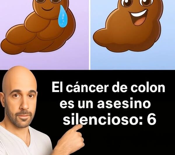 Cáncer de Colon en Jóvenes: Un Preocupante Aumento y Cómo Prevenirlo