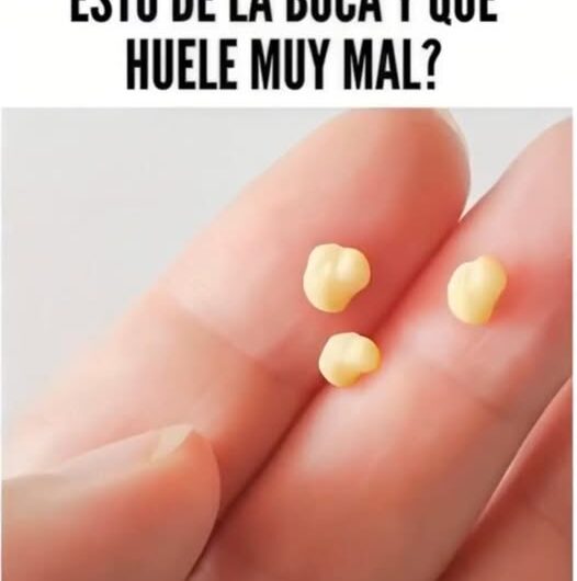 ¿Te Ha Salido Esto en la Boca y Huele Mal? Descubre las Causas y Remedios Naturales