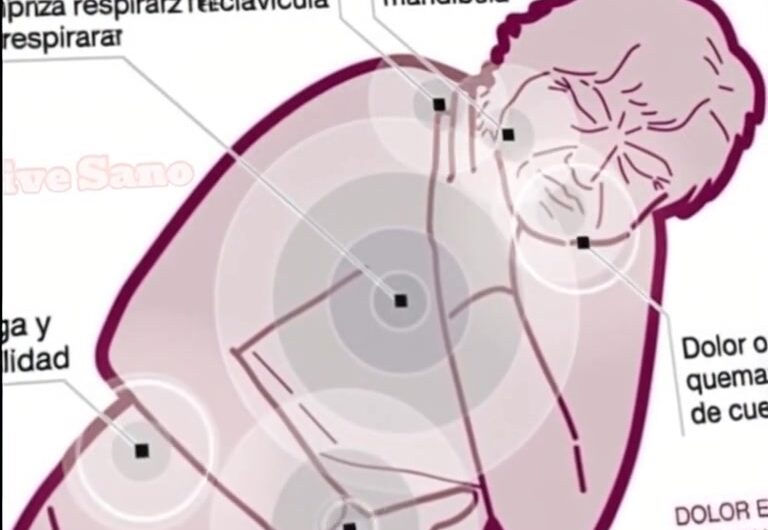 Infarto en Mujeres: Señales Atípicas que Muchas Pasan por Alto