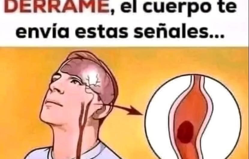 ¡Atención a las señales! Tu Cuerpo Puede Advertirte un Derrame Cerebral Hasta un Mes Antes
