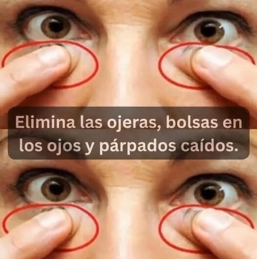 Elimina las Ojeras y Bolsas en los Ojos: Remedios Naturales y Eficaces