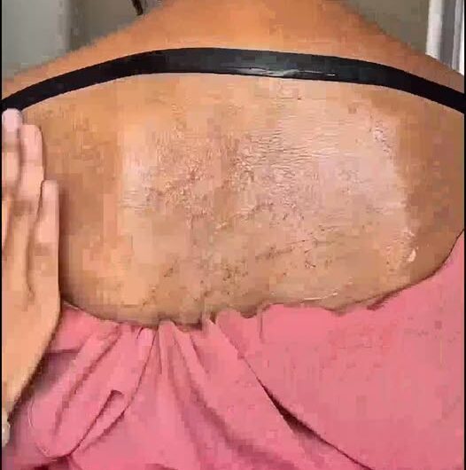 Exfoliante Natural: Tu Nuevo Aliado para una Piel Radiante