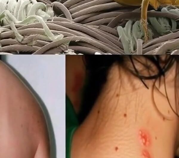 Si te salen estos insectos en tu cama, es señal de que debes actuar rápido