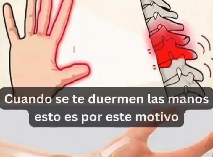 Por Qué se Adormecen las Manos y Cómo Aliviarlo de Forma Natural