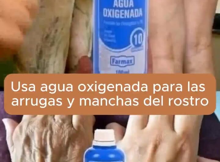 Elimina Manchas y Arrugas de Forma Natural con Agua Oxigenada
