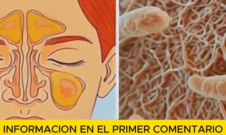 Remedios Naturales para Eliminar el Moco y la Flema en la Garganta y Nariz