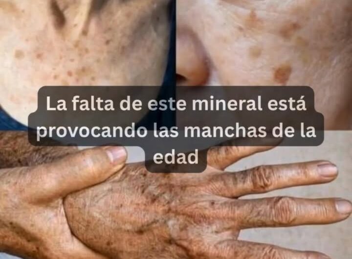La Relación Entre la Falta de Minerales y las Manchas en la Cara