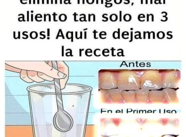 Adiós a sarro y mal aliento: el remedio natural que tu boca necesita