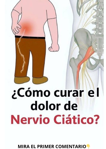 Adiós al Dolor Lumbar y Ciática: Técnicas Efectivas para Aliviar el Malestar