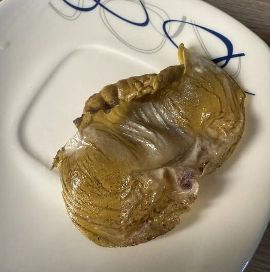 Molleja de gallina de campo para dejar la bebida: un remedio tradicional