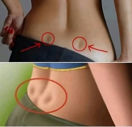 Hoyuelos de Venus: Comprendiendo su Significado y Salud