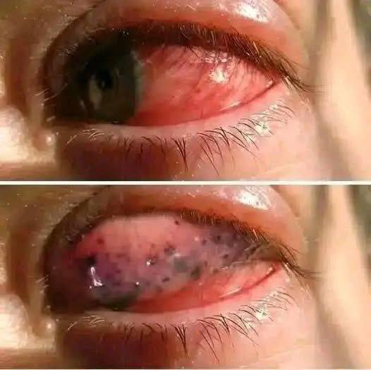 Dormir con los ojos rojos: consecuencias que no debes ignorar