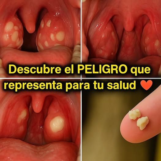 Combate el Mal Aliento de Forma Natural y Efectiva