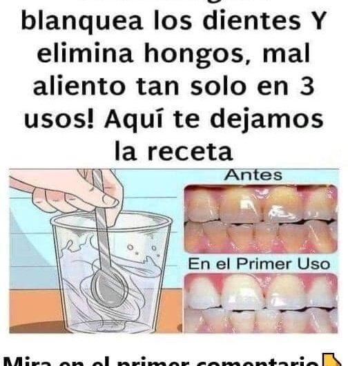 Elimina Hongos y el Mal Aliento de Forma Natural y Efectiva