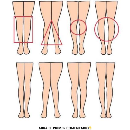 Las Piernas de la Mujer: Una Ventana a Su Salud y Bienestar