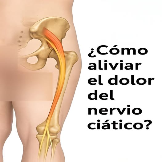 El Nervio Ciático: Alivio a Través de Técnicas y Remedios Conscientes