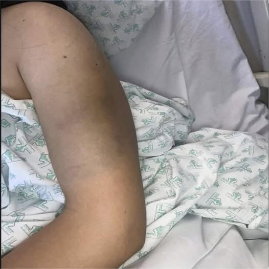 Consecuencias de No Cuidar Tu Salud: Remedios Naturales para Recuperarte