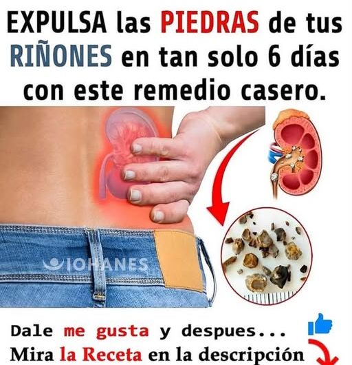 Riñones Sanos, Vida Sana: Desintoxícalos con Estos Remedios Naturales