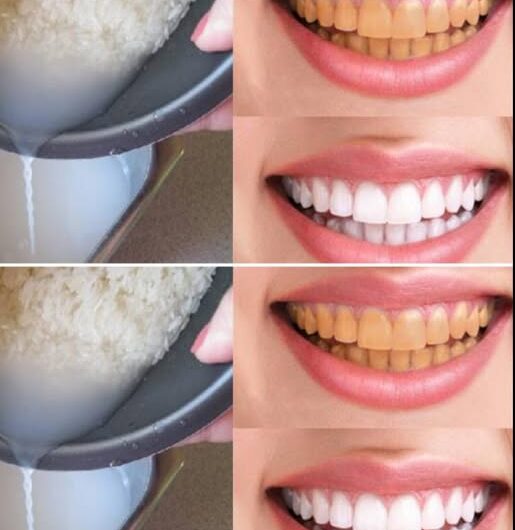 "¡Sonrisa radiante en 60 segundos! Descubre este truco casero para blanquear tus dientes al instante"