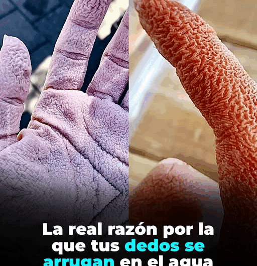 ¿Por qué tus dedos se arrugan después de un baño largo?