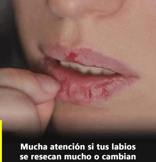 Tus Labios: Un Espejo de tu Salud Interna