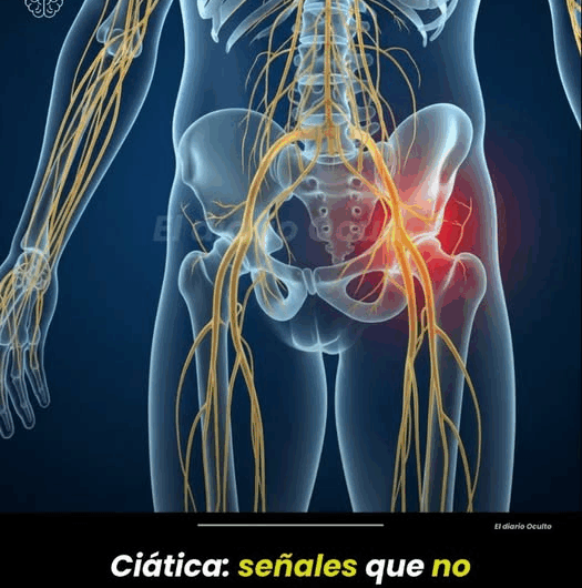 Ciática: Señales que No Debes Ignorar
