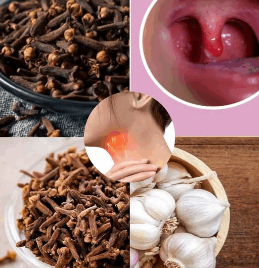 Antibiótico natural para calmar el dolor de garganta e inflamación