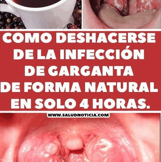 Combate el Mal Aliento de Forma Natural y Efectiva