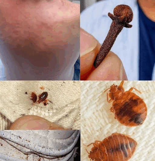 Cómo Actuar ante una Plaga de Insectos en el Colchón: Soluciones Naturales y Efectivas