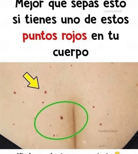 Puntos Rojos en la Piel: Descifrando los Mensajes de tu Cuerpo