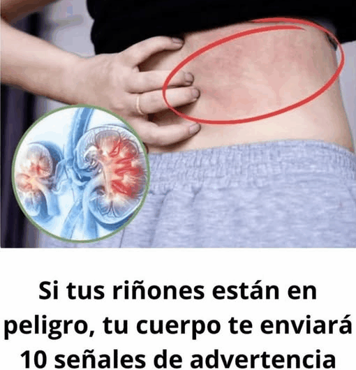 Si Tienes Estos 8 Signos, Tus Riñones Podrían Estar en Peligro