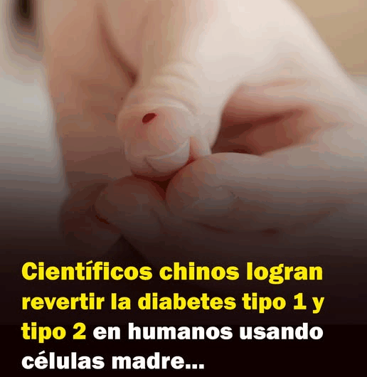 Científicos chinos logran revertir la diabetes tipo 1 y tipo 2 en humanos usando células madre.