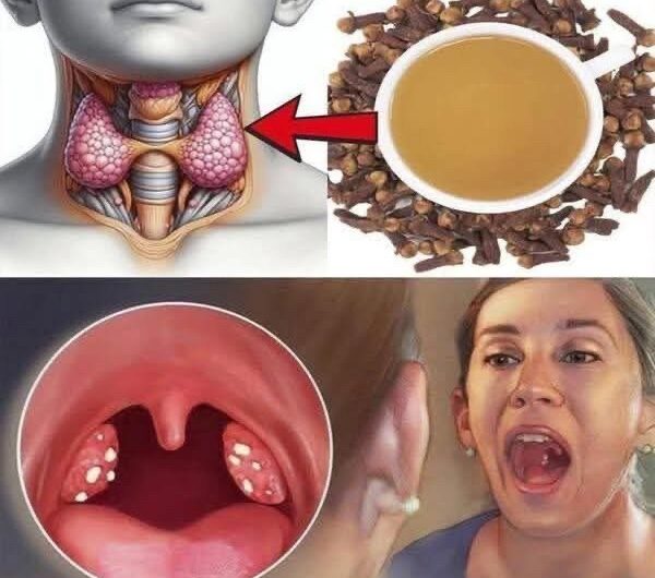 Elimina el Dolor de Garganta e Inflamación: Remedios Naturales Efectivos