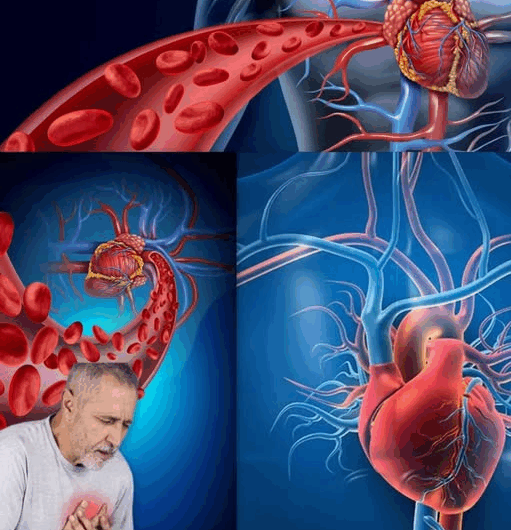 Cómo Limpiar y Proteger tus Vasos Sanguíneos de Forma Natural