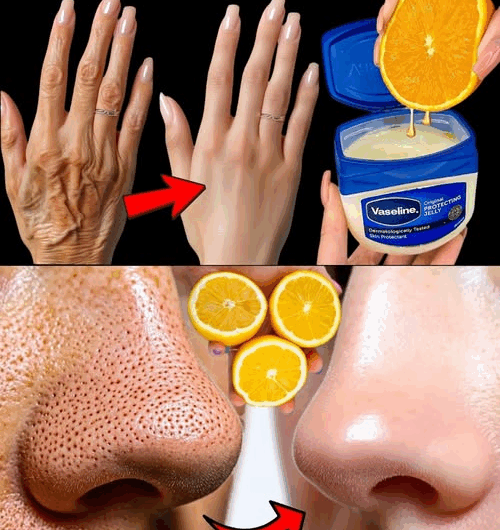 El Limón: Un Aliado Natural para la Belleza de tu Piel