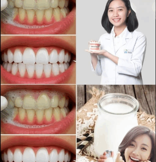 "¡Sonrisa radiante en 60 segundos! Descubre este truco casero para blanquear tus dientes al instante"
