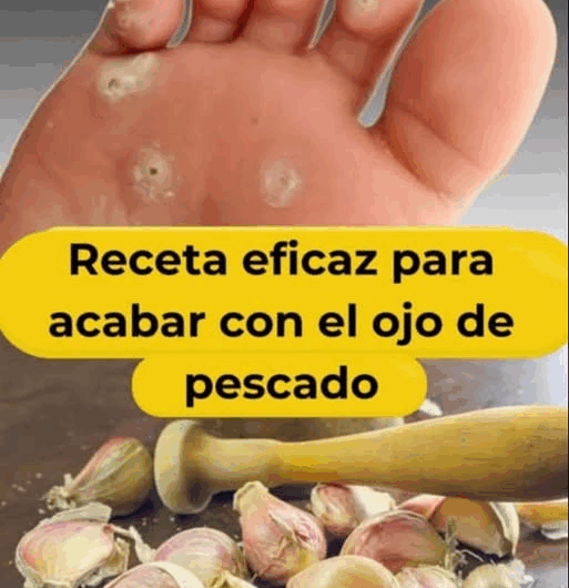 Deshazte del ojo de pescado con estos efectivos remedios naturales con ajo