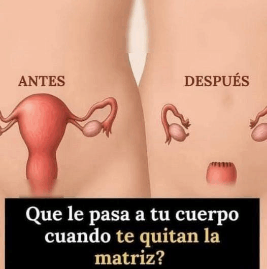 ¿Qué sucede realmente en tu cuerpo cuando te quitan la matriz?