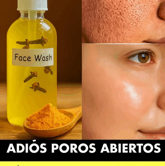 Adiós poros abiertos con este tónico natural de clavo y cúrcuma
