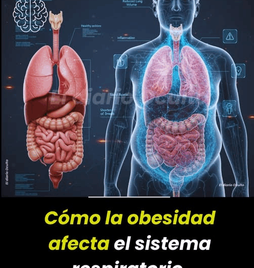 La Obesidad y su Impacto en el Sistema Respiratorio: Recetas Naturales de Apoyo