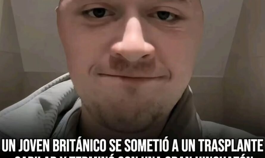 Joven británico sufre fuerte inflamación facial tras someterse a cirugía capila