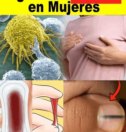 14 Señales de Alerta del Cáncer de Mama