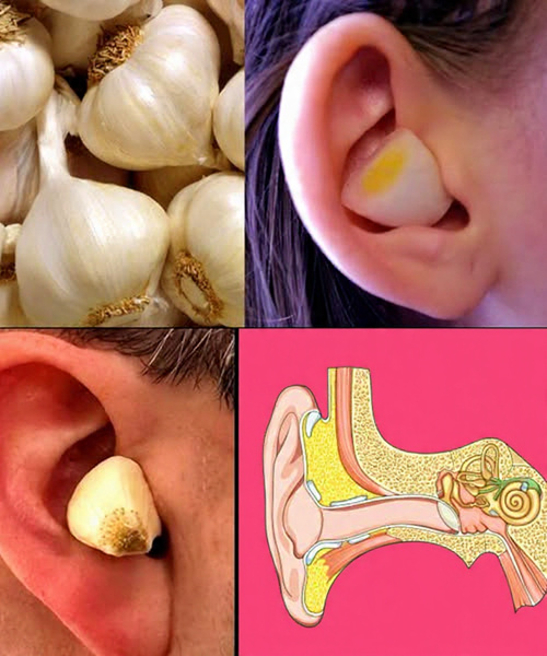 El Poder del Ajo en el Oído: El Remedio Natural que Alivia el Dolor y