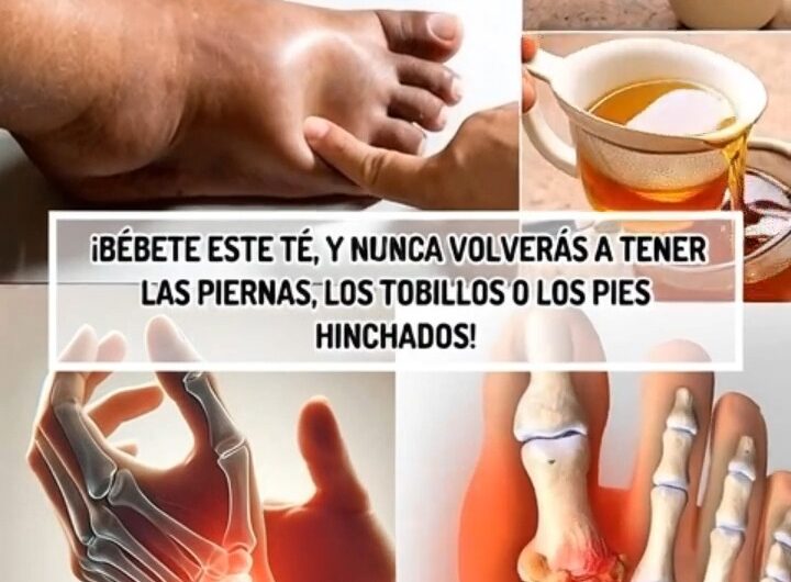 Té de Cilantro y Cola de Caballo: Remedio Natural para la Retención de Líquidos.