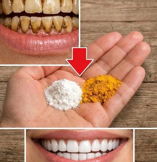 Recetas Naturales para Limpiar y Blanquear los Dientes de Forma Suave