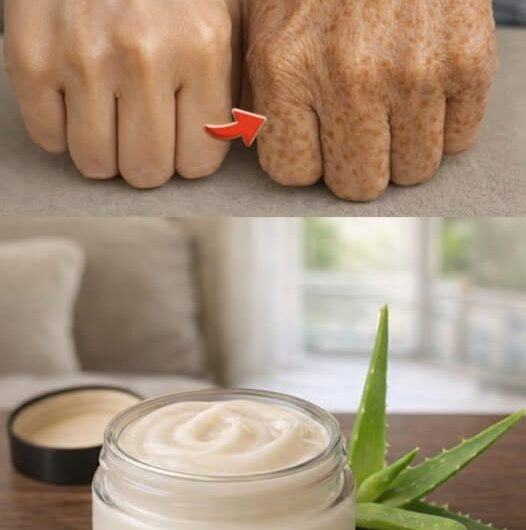 Mascarillas naturales con aloe vera y bicarbonato para aclarar el cuerpo y suavizar las arrugas